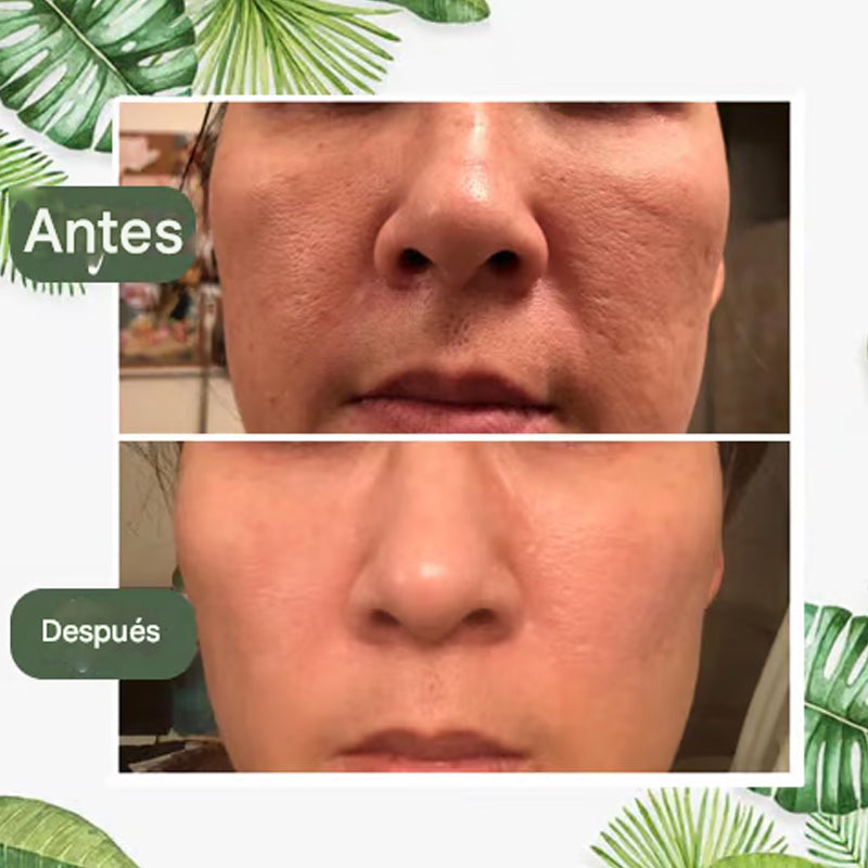Mascarilla de té verde de limpieza profunda