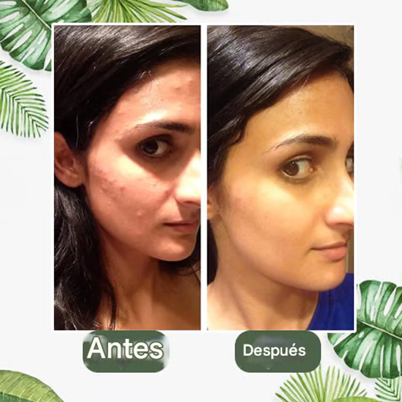Mascarilla de té verde de limpieza profunda