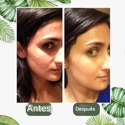 Mascarilla de té verde de limpieza profunda